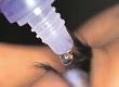 Using Drops and Ointments for Your Eyes