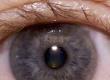 What a Cornea Transplant Involves