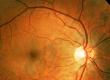 Does an Optic Nerve Grow?