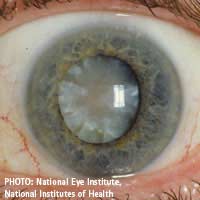 Blurred Vision diabetes surgery