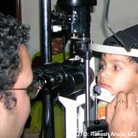 Shingles eye Drops herpes Zoster